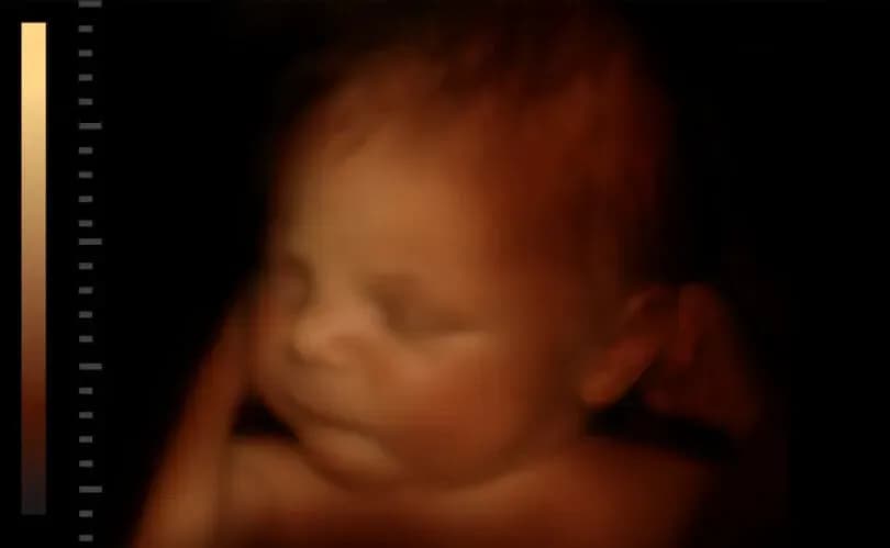 Texas Senate approves pro-life statue honoring unborn children at state capitol