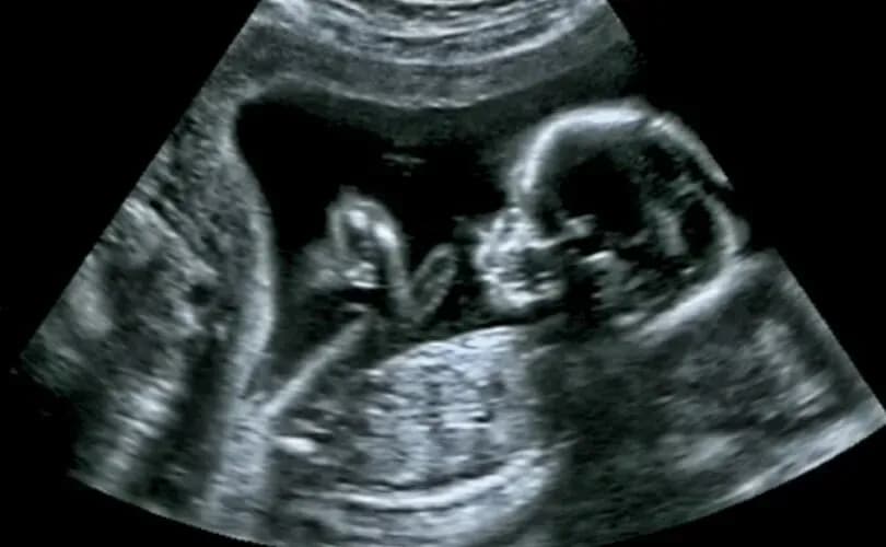 Canada at risk of becoming 'haven' for US abortionists, pro-life leader warns