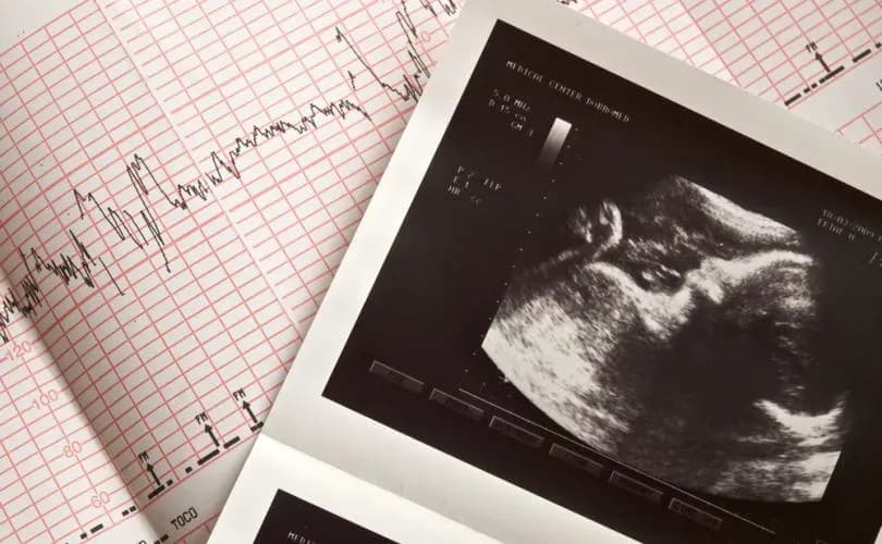 South Carolina Supreme Court hears new arguments over heartbeat abortion ban