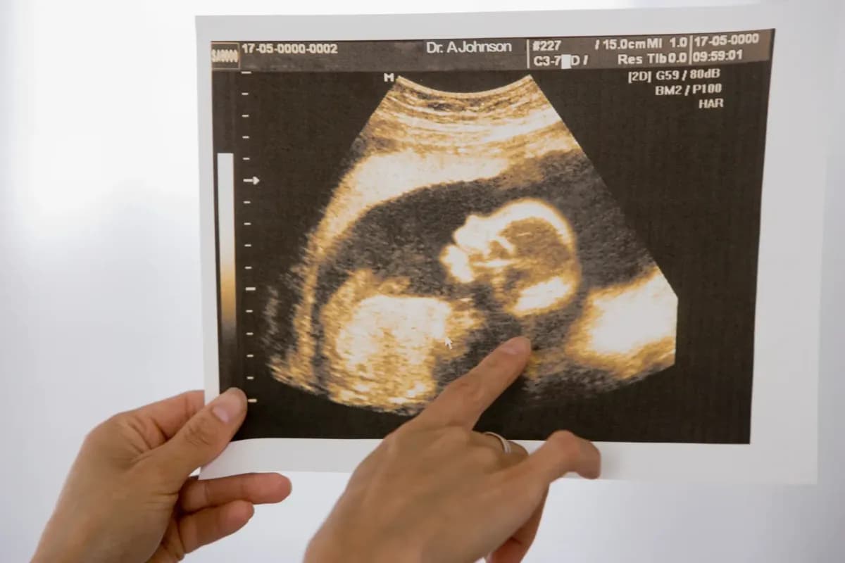 Texas county becomes 7th to take steps to outlaw abortion