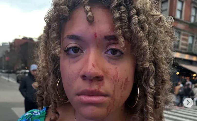 Pro-abortion woman assaults pro-life journalist during street interview in New York