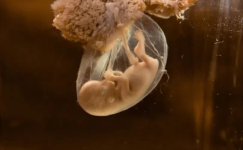 19 states file brief defending Georgia's heartbeat law under attack by abortion activists