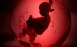 Thumbnail for Christian group to sue Ontario city over law banning pro-life speech