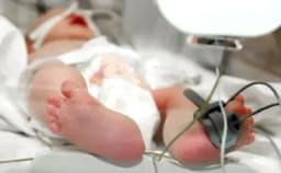 Thumbnail for 150 babies were born alive after botched abortions in Canada the past two years
