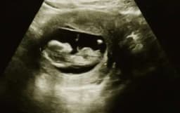 Thumbnail for Pro-life group gives 'green light' to over 100 candidates running in Canada's federal election