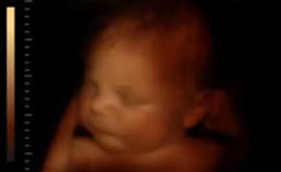 Thumbnail for Texas Senate approves pro-life statue honoring unborn children at state capitol