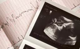 Thumbnail for South Carolina Supreme Court hears new arguments over heartbeat abortion ban