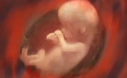 Thumbnail for 19 Ontario women sent to US for abortions, costing taxpayers over $300,000