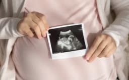 Thumbnail for Trump’s executive order against gender ideology recognizes personhood at conception