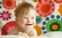 Thumbnail for Scotland’s shame: Down syndrome abortions jump 82% since 2021